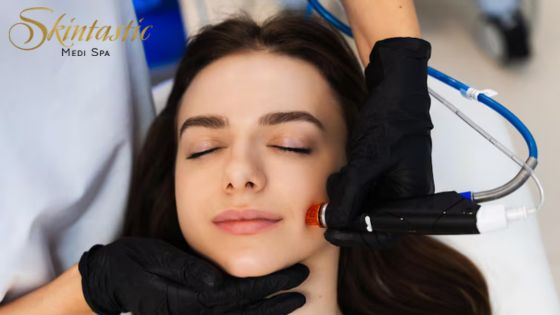 Hydrafacial in Riverside for Smooth and Glowing Skin